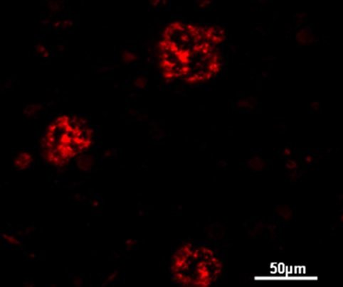 immunofluorescent staining of amyloid deposits_M. Canovi et al.  Biomaterials 32 2011