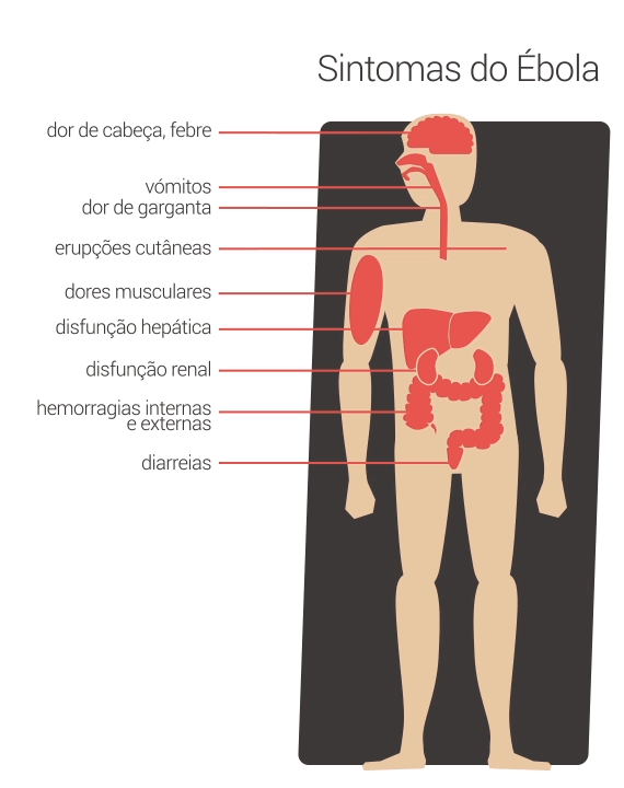 ebola-sintomas