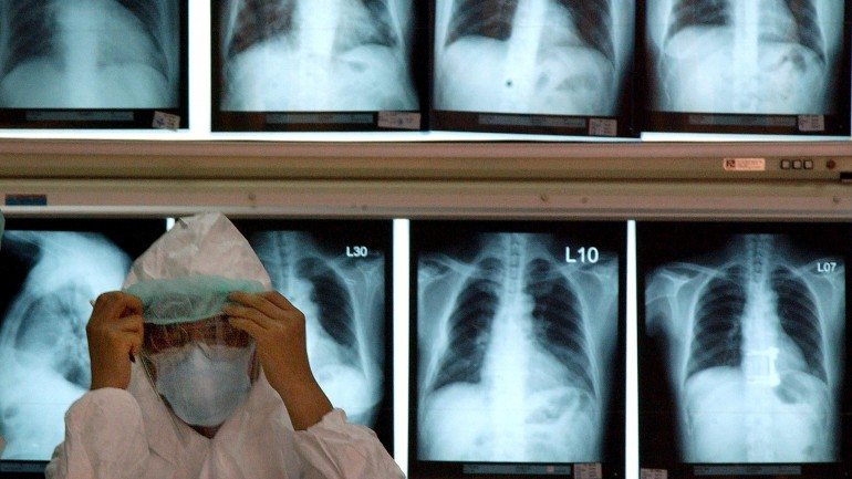 Estudo de investigadores da Universidade de Coimbra acerca do cancro do pulmão foi distinguido internacionalmente