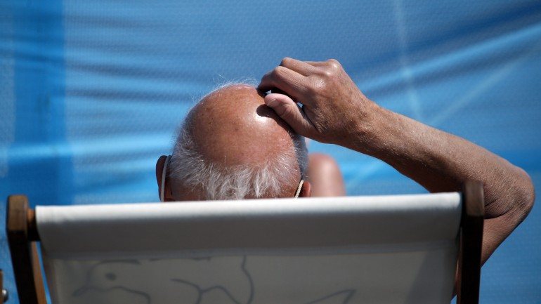 A queda de cabelo (alopécia) afeta mais de metade dos homens caucasianos em idade adulta