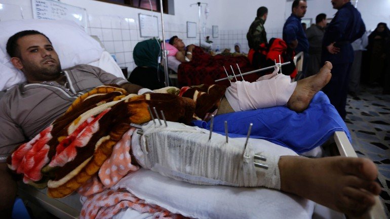 Um guerrilheiro curdo num hospital em Kirkuk