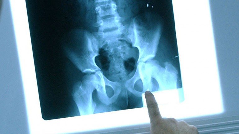As imagens de um raio-X contém muito menos informação que as da nova tecnologia