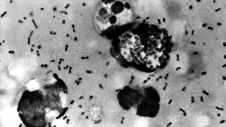 Imagem da bactéria Yersinia pestis, causadora de vários tipos de peste e mortífera