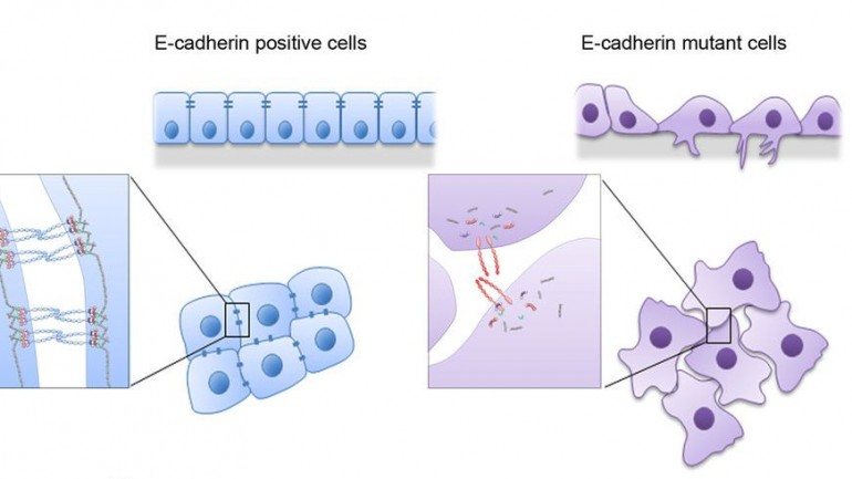 Células com a proteína de ligação funcional (a azul) e com alterações (a lilás)