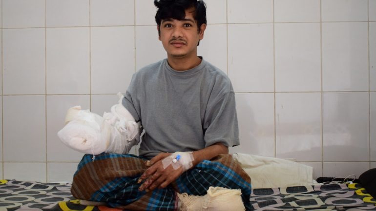 Ao longo de 2016, o jovem, natural do Bangladesh, foi submetido a 16 operações para eliminar as malformações que escondiam as suas mãos e chegavam a pesar cinco quilos