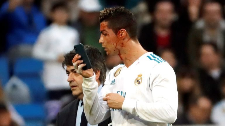 Cristiano Ronaldo pediu um telemóvel para ver os ferimentos na cara