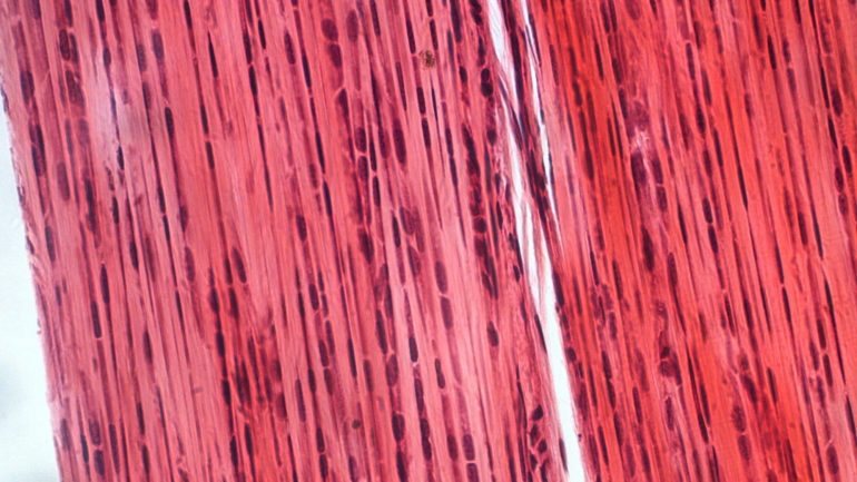 Exemplo de tecido conjuntivo denso num tendão