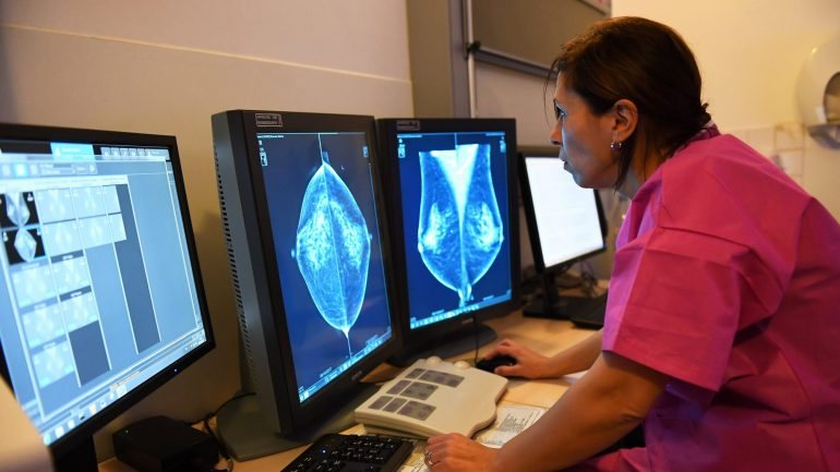 Um dos tipos de cancro de mama está ligado às hormonas femininas, estrogénio e progesterona