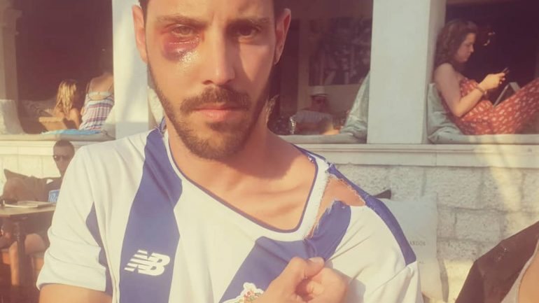 Rafael Barbosa publicou nas redes sociais uma mensagem a denunciar a situação, juntamente com uma fotografia sua, onde se vê a camisola rasgada e alguns ferimentos na cara.