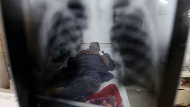 O coordenador do Programa Nacional de Controlo da Tuberculose disse que, nos últimos três anos, a tuberculose tem representado a terceira causa de morte em Angola, superada pela malária e pelos acidentes de viação