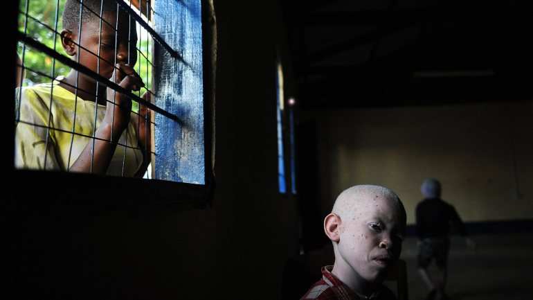 Estas mortes nada têm a ver com os homicídios de albinos, que acontecem com frequência na Tanzânia e em outras zonas da África oriental