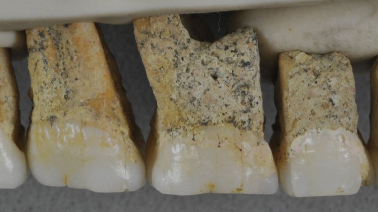 No total, foi encontrada numa gruta nas Filipinas uma dúzia de partes do corpo fossilizadas, desde dentes, um osso da coxa, ossos dos dedos e ossos do pé