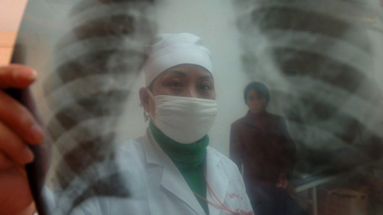 O cancro do pulmão mata mais de um milhão de pessoas por ano em todo o mundo