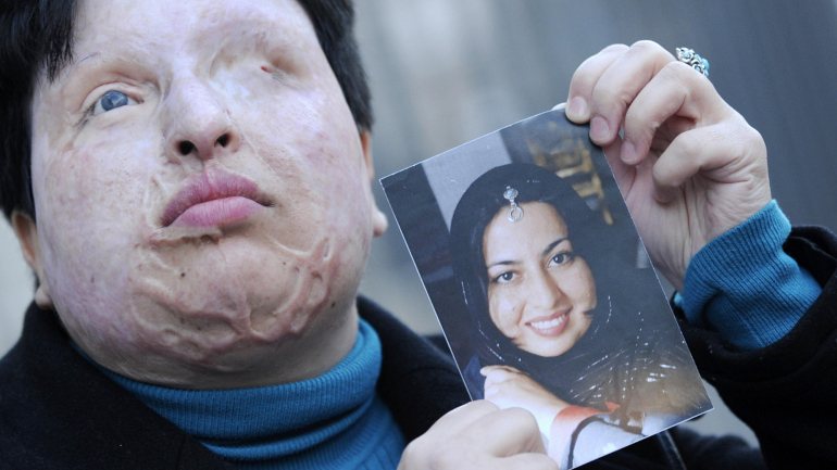 Ameneh Bahrami, iraniana, posa com uma fotografia de como era antes de um homem a atacar com ácido. Como pena, o atacante também foi cegado com ácido