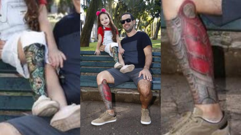 Túlio Catelani tatuou um desenho semelhante na mesma perna que os médicos amputaram à criança