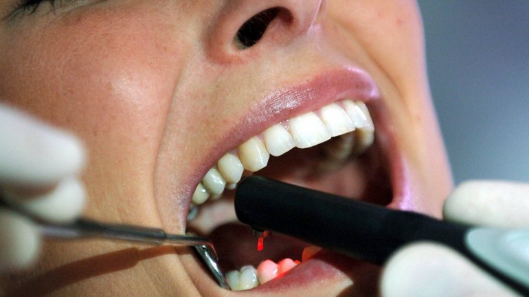 Mais de um em cada três portugueses (35,7%) não vai ao dentista há mais de um ano e mais de metade nunca mudou de médico dentista