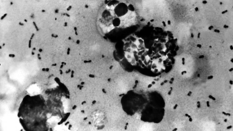 A bactéria encontrada nestes pacientes é a mesma que causou a Peste Negra, uma pandemia que matou até 200 milhões de pessoas no século XIV