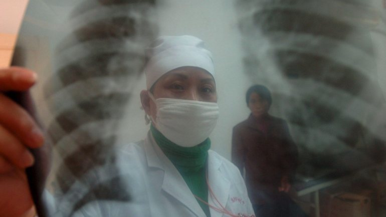 Bronquiolite obliterante é uma forma rara de doença pulmonar obstrutiva crónica semelhante às lesões que o jovem apresentava