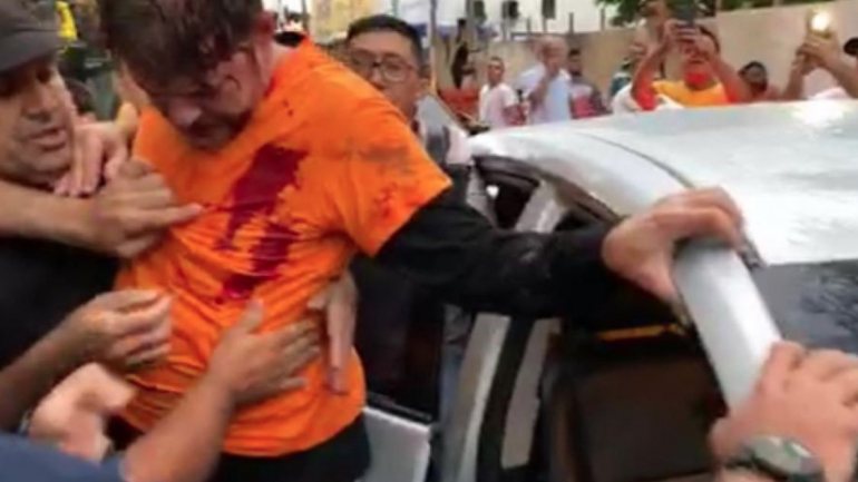 Imagens mostram o político consciente e com a roupa manchada de sangue após os disparos