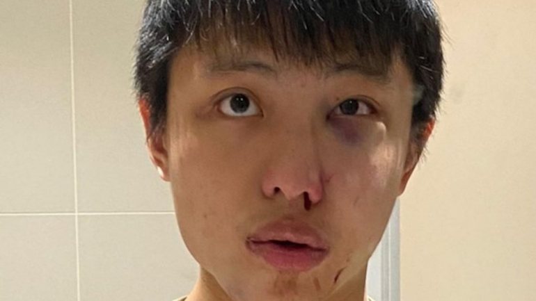 Jonathan Mok, um estudante de Singapura, a frequentar a University College London, terá sido alvo de um ataque racista por parte de um grupo de quatro homens e uma mulher