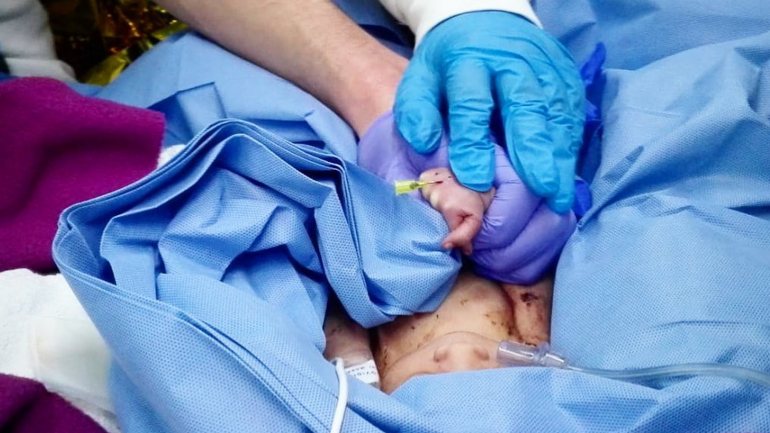Na passada terça-feira nasceu o primeiro bebé filho de uma mãe infetada com a Covid-19 em Portugal