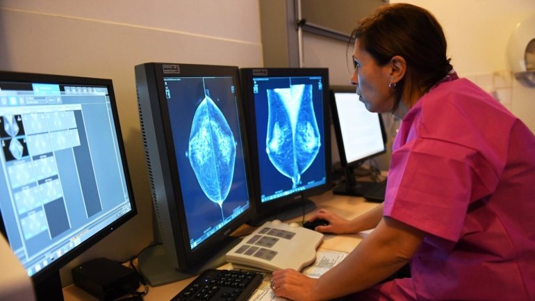 Em 2019, mais de 300 mulheres foram convidadas para participar neste programa de rastreio do cancro da mama