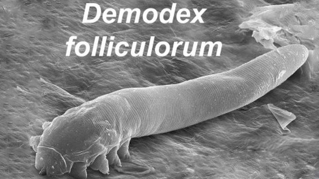 Os ácaros 'Demodex folliculorum' medem 0,3 milímetros e vivem nos poros da nossa cara e mamilos