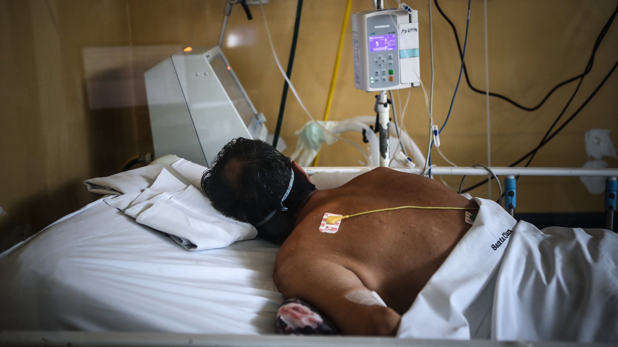 epa09175903 A pacient lies on bed as medical staff work at an intensive care unit in a hospital in Buenos Aires, Argentina, 28 April 2021 (issued 03 May 2021). Argentina enters a new stage of measures to stop the second wave of covid-19 and avoid health chaos, which include older people restrictions, especially in the metropolitan area of Buenos Aires, the most affected by the virus.  EPA/Juan Ignacio RONCORONI