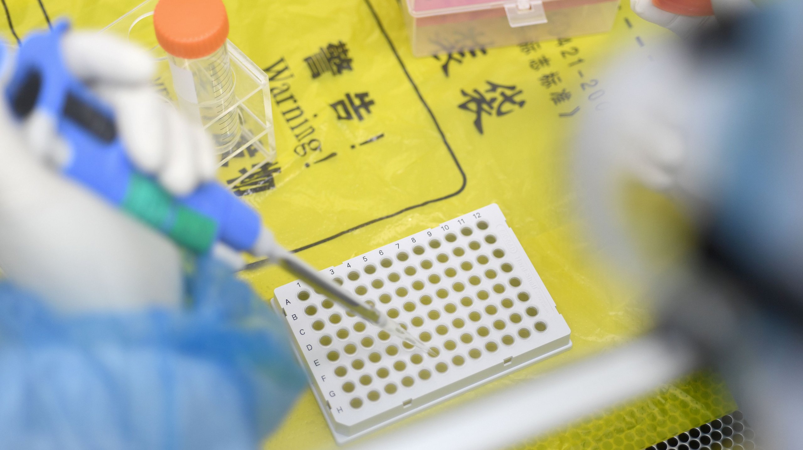 O Instituto de Virologia de Wuhan já estudava coronavírus antes da pandemia