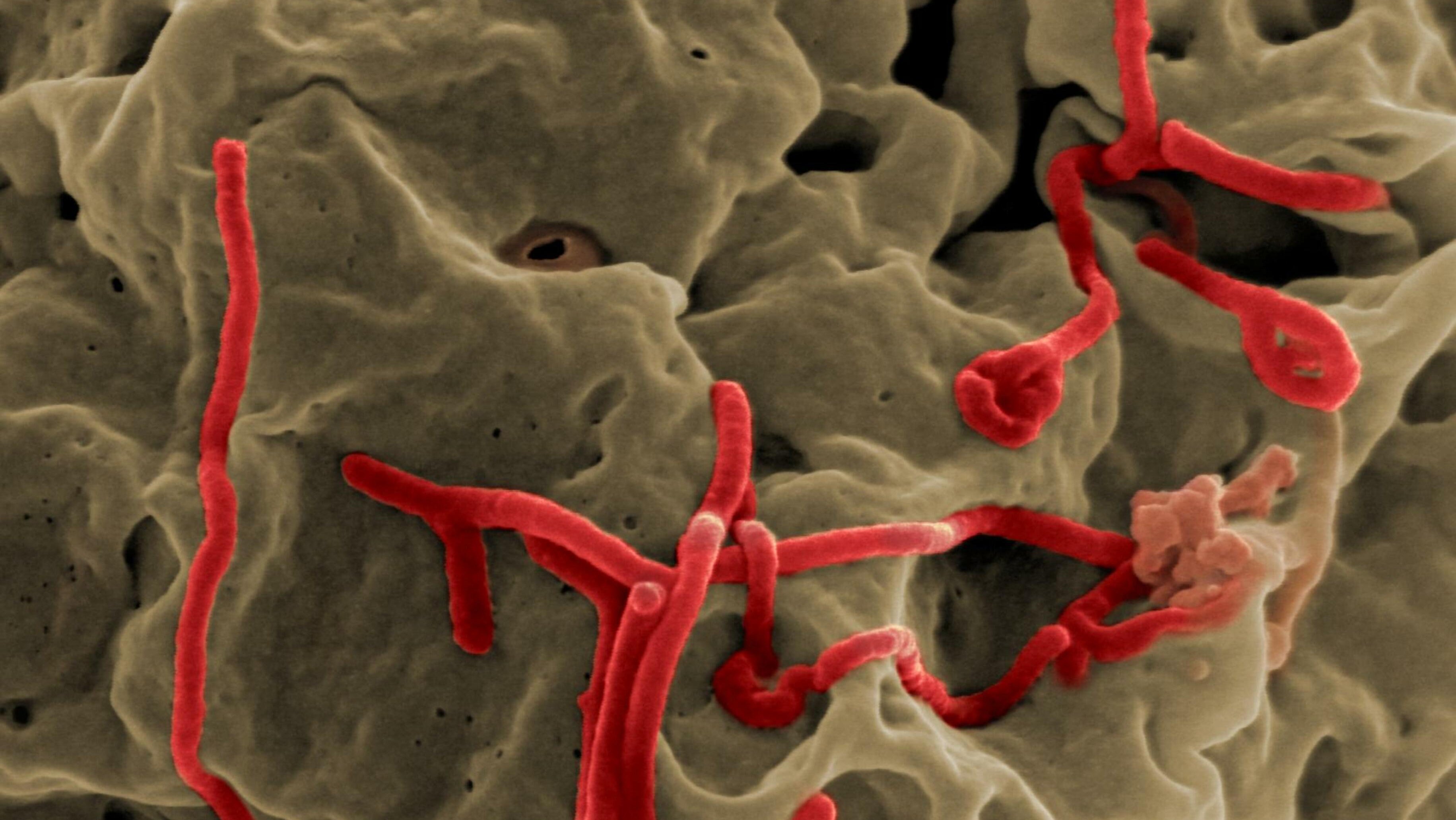 Vírus ébola visto ao microscópio eletrónico