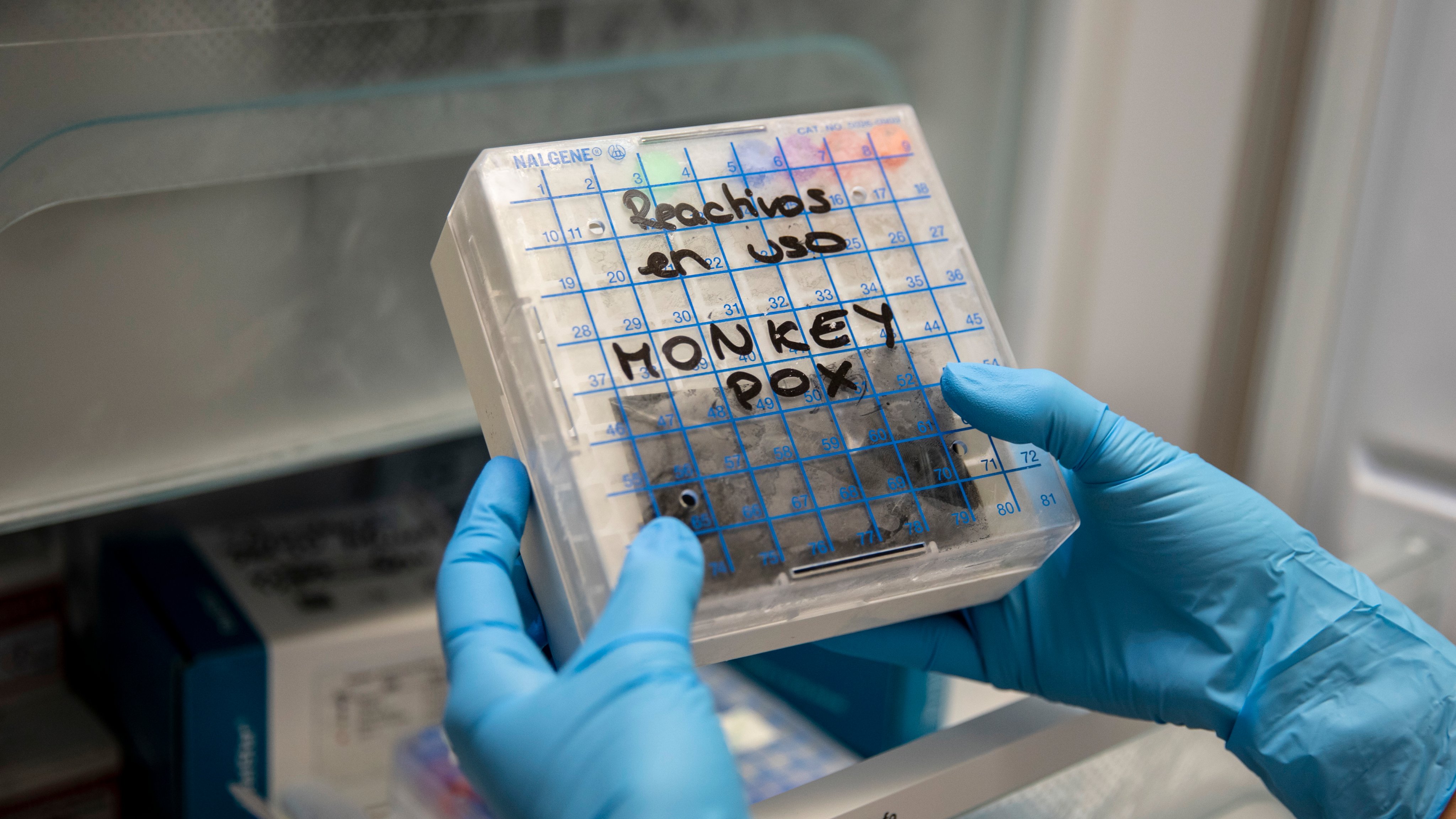 Spain Sets Up Monkeypox Testing Site As Cases on The Rise