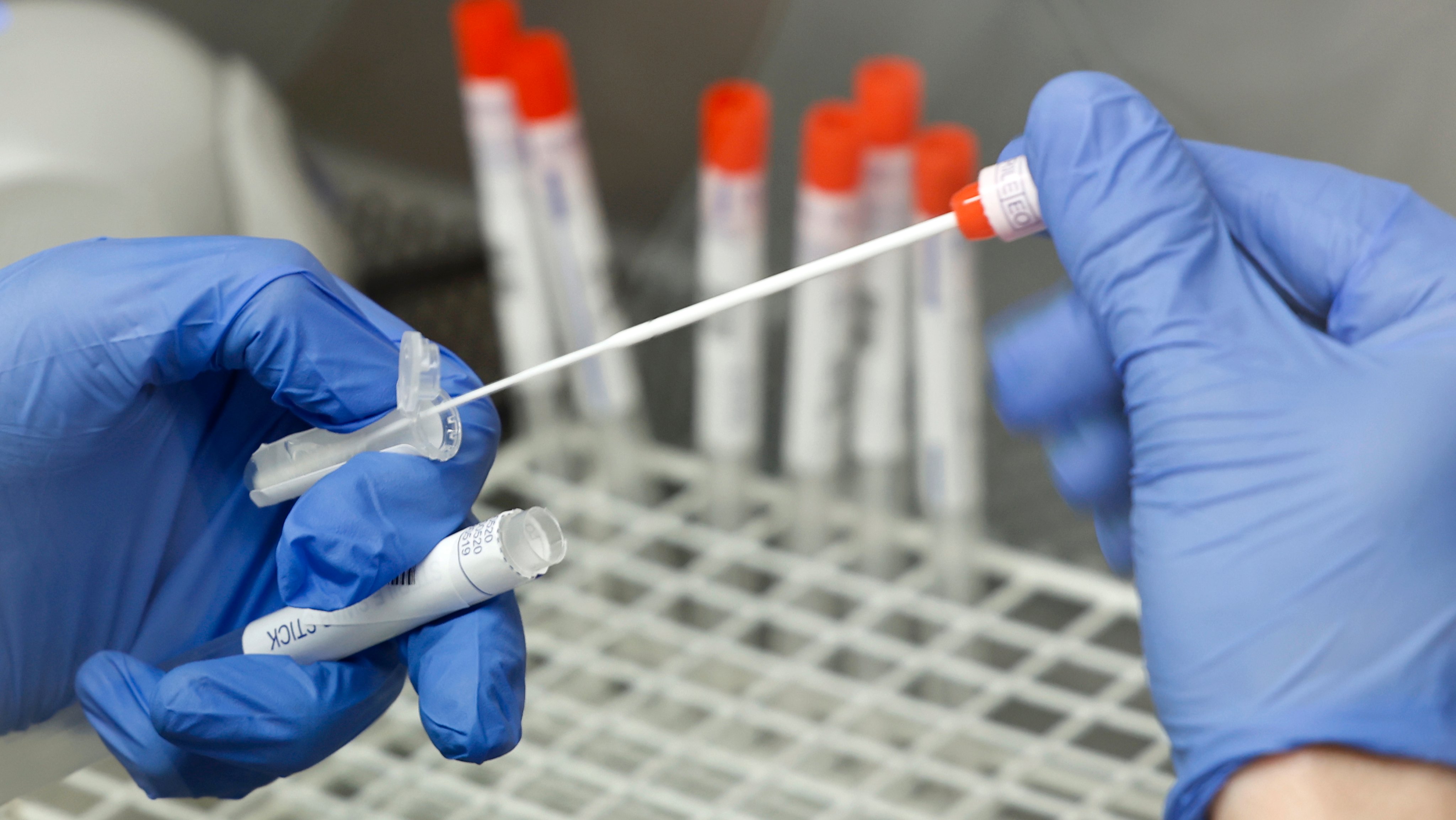 Teste PCR para o coronavírus