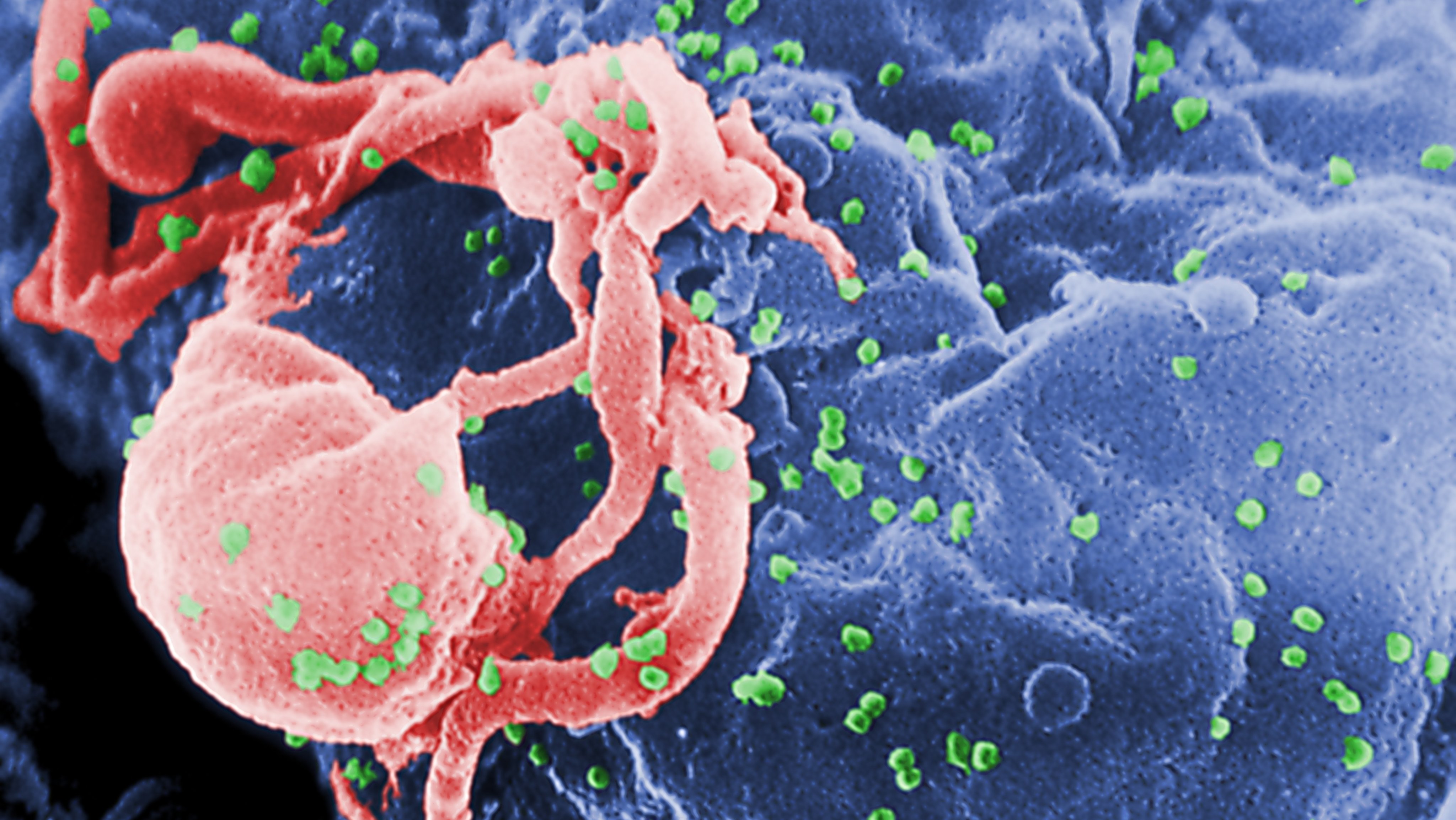HIV-1 Virions