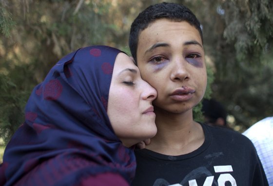 Tariq Abu Khder (C), a Palestinian-US teenager who was allegedly beaten during police custody, is hugged by his mother (L) following a hearing at Jerusalem Magistrates Court on July 6, 2014. Tariq Abu Khder, who was arrested in Shuafat during violent clashes between stonethrowers and Israeli riot police, "was given nine days house arrest in Beit Hanina for the duration of the investigation" into stonethrowing allegations, police spokeswoman Luba Samri said in a statement. AFP PHOTO / AHMAD GHARABLI        (Photo credit should read AHMAD GHARABLI/AFP/Getty Images)