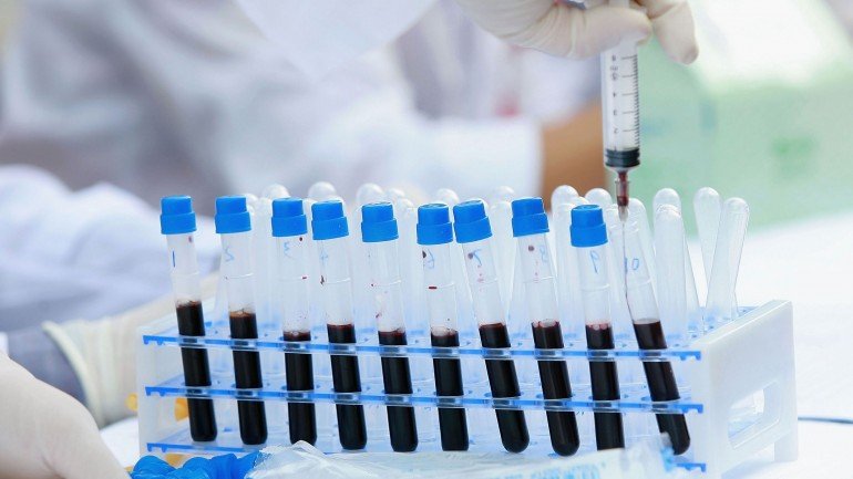 Testes da sida incluídos nos pedidos de análises de rotina