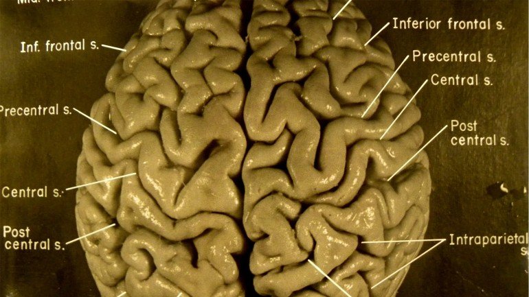 O cérebro de Einstein foi recolhido durante a sua autópsia em 1955