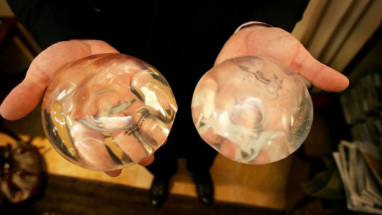 Os implantes de silicone estiveram banidos nos Estados Unidos durante 14 anos por questões de segurança