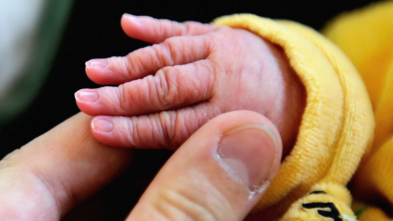 Bebé sofre de ictiose arlequim, uma doença de pele rara que a deixa espessa e seca